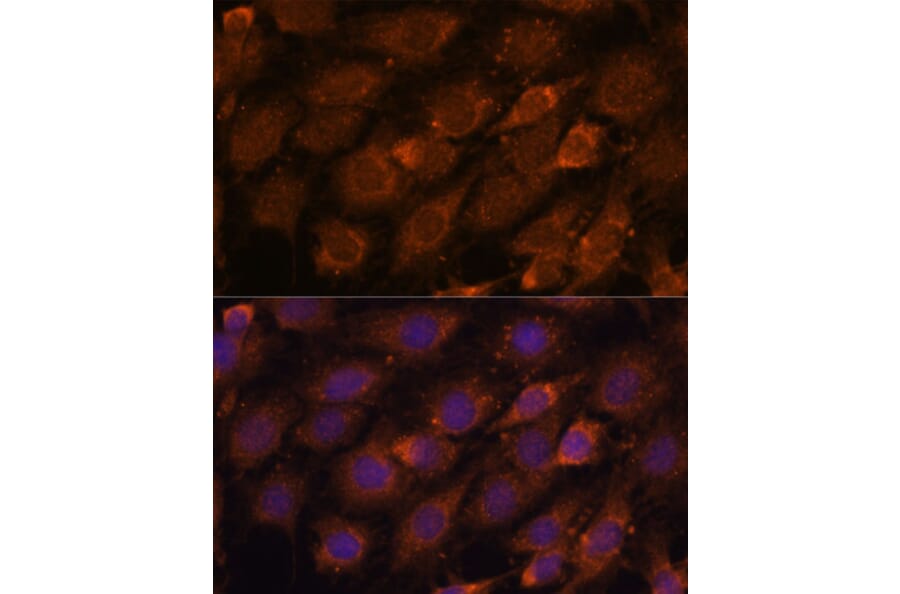Immunofluorescence - Anti-CREB3 Antibody (A11991) - Antibodies.com