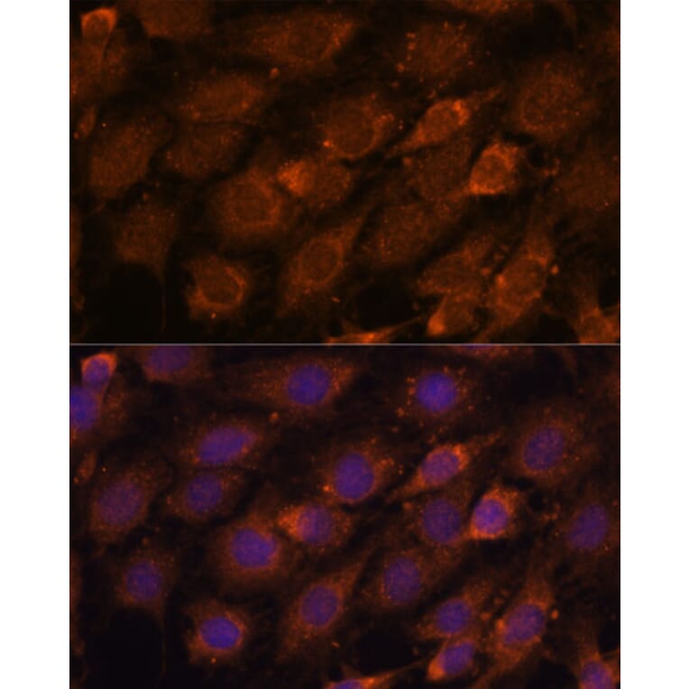 Immunofluorescence - Anti-CREB3 Antibody (A11991) - Antibodies.com
