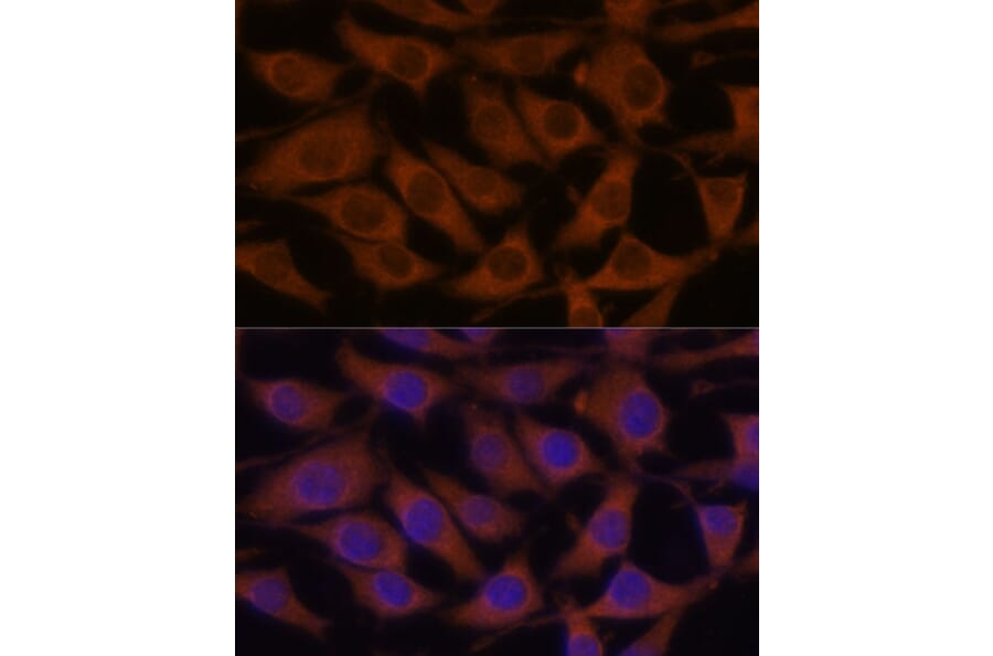 Immunofluorescence - Anti-CREB3 Antibody (A11991) - Antibodies.com
