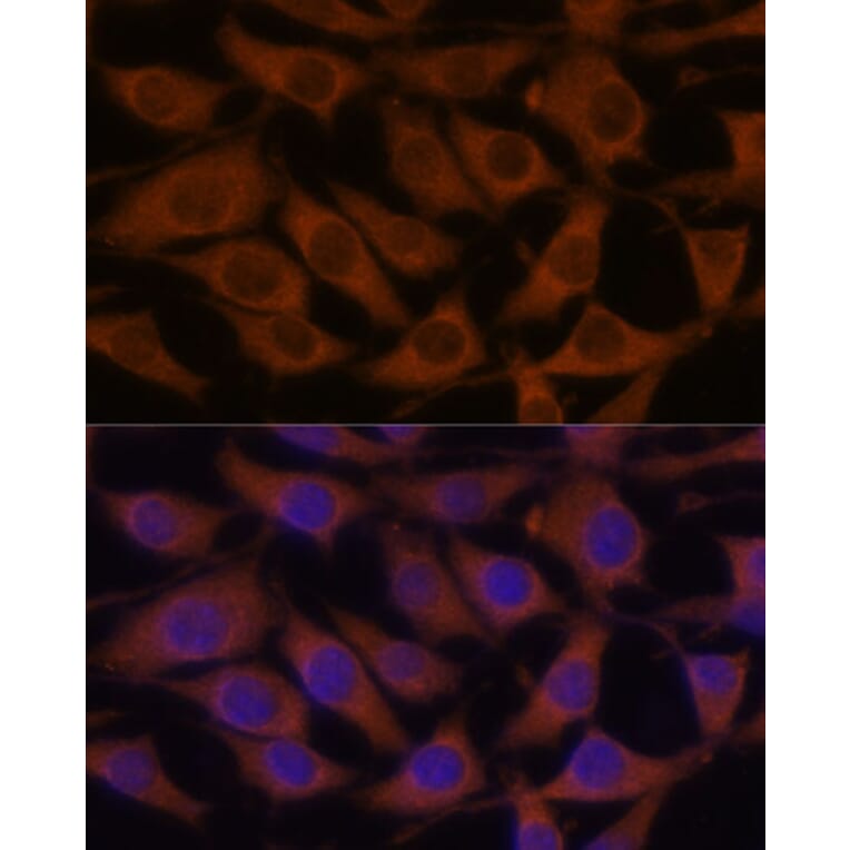 Immunofluorescence - Anti-CREB3 Antibody (A11991) - Antibodies.com