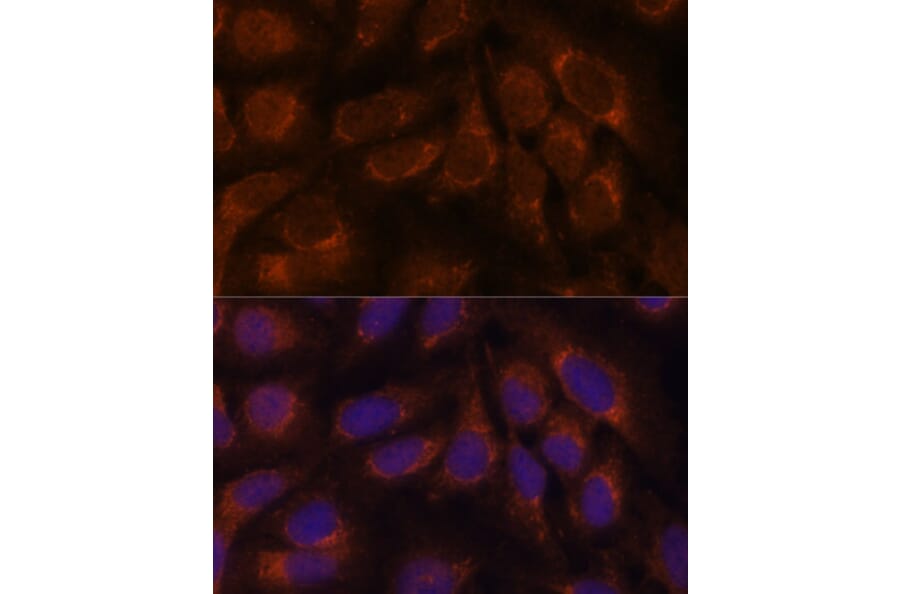 Immunofluorescence - Anti-CREB3 Antibody (A11991) - Antibodies.com