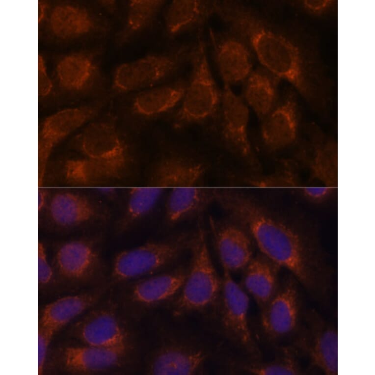 Immunofluorescence - Anti-CREB3 Antibody (A11991) - Antibodies.com