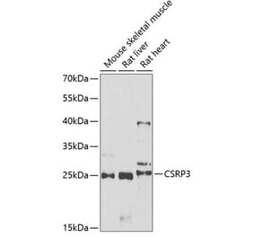 Western Blot - Anti-CSRP3 Antibody (A11992) - Antibodies.com