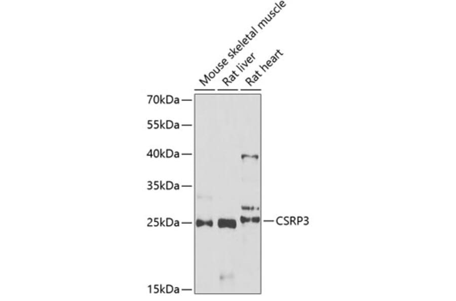Western Blot - Anti-CSRP3 Antibody (A11992) - Antibodies.com