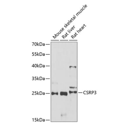 Western Blot - Anti-CSRP3 Antibody (A11992) - Antibodies.com