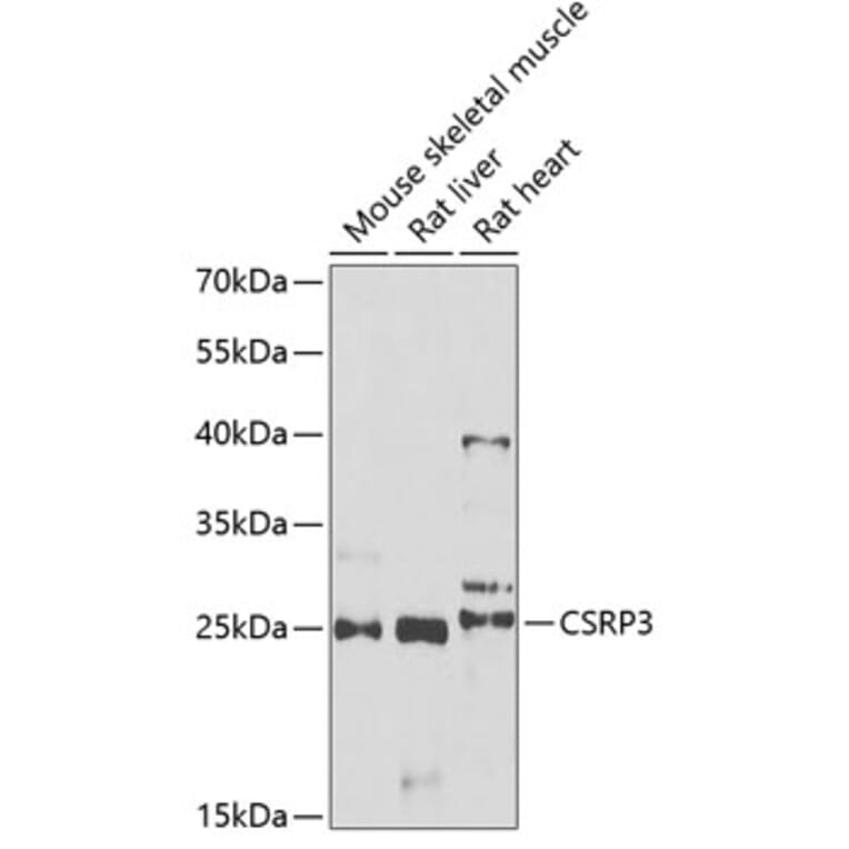 Western Blot - Anti-CSRP3 Antibody (A11992) - Antibodies.com