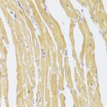 Immunohistochemistry - Anti-CSRP3 Antibody (A11992) - Antibodies.com