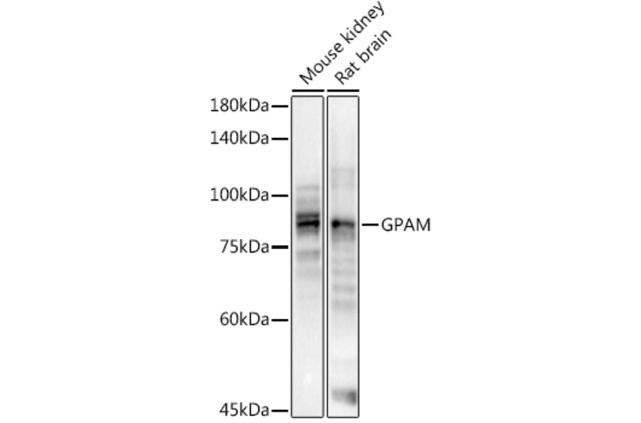 Western Blot - Anti-GPAM Antibody (A11993) - Antibodies.com