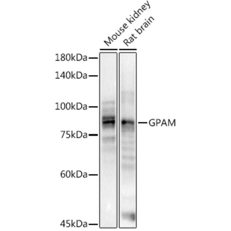 Western Blot - Anti-GPAM Antibody (A11993) - Antibodies.com