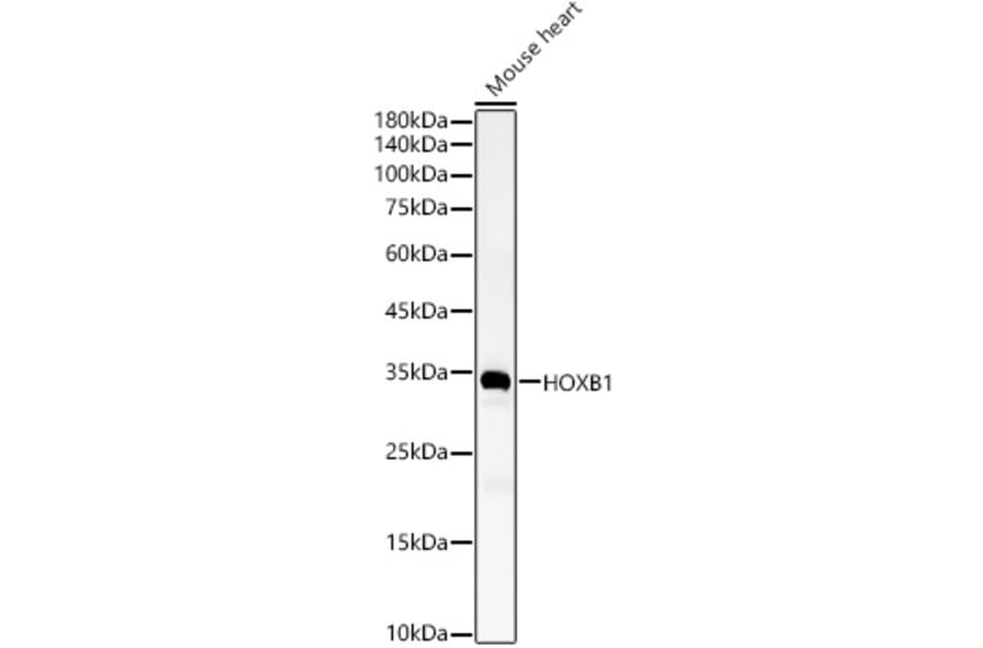 Western Blot - Anti-HOXB1 Antibody (A11994) - Antibodies.com