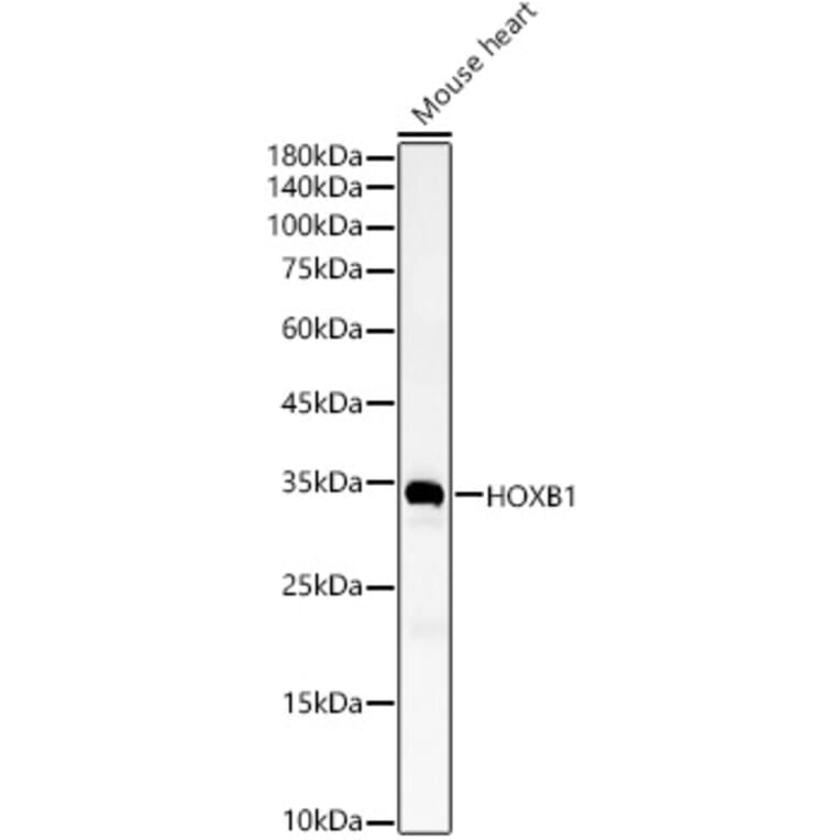 Western Blot - Anti-HOXB1 Antibody (A11994) - Antibodies.com