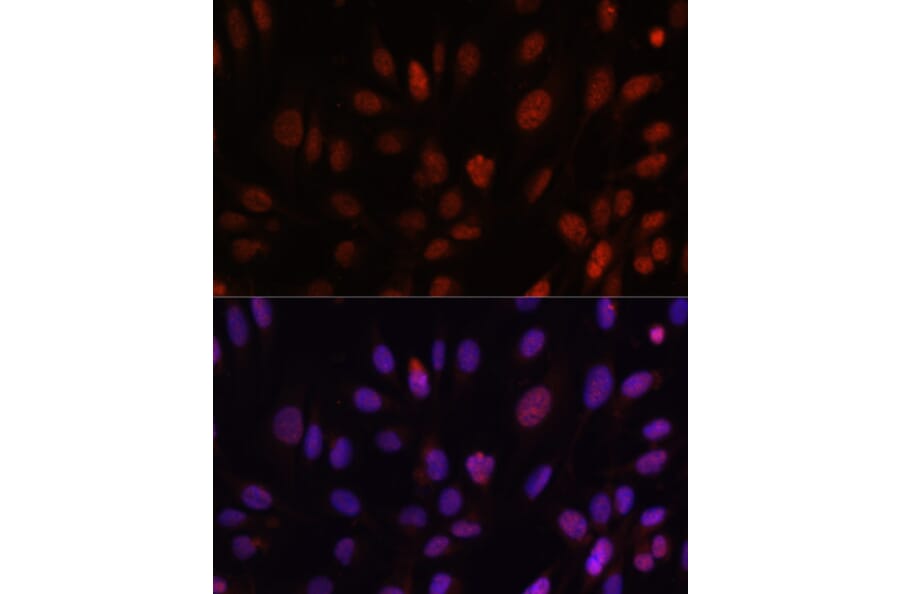 Immunofluorescence - Anti-HOXB1 Antibody (A11994) - Antibodies.com