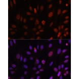 Immunofluorescence - Anti-HOXB1 Antibody (A11994) - Antibodies.com