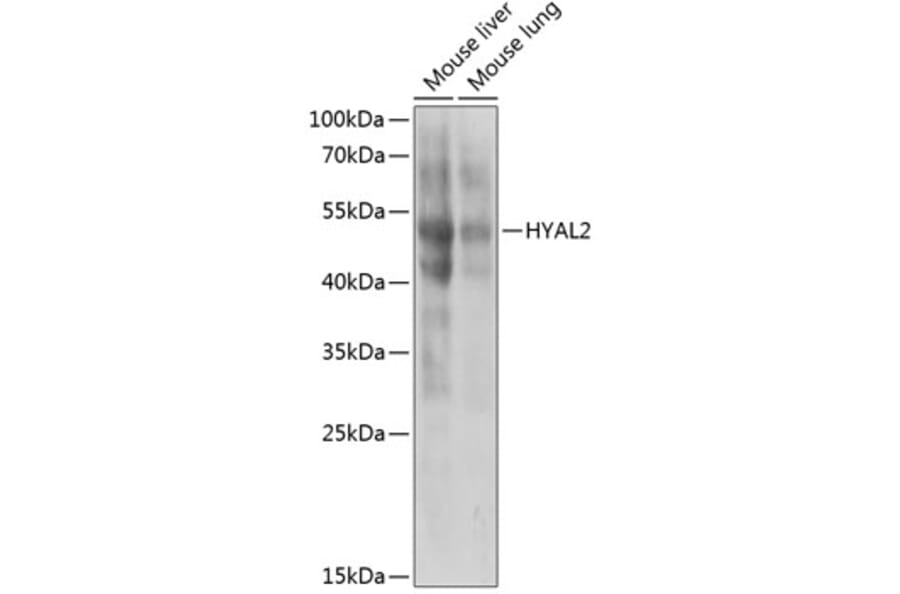 Western Blot - Anti-HYAL2 Antibody (A6624) - Antibodies.com