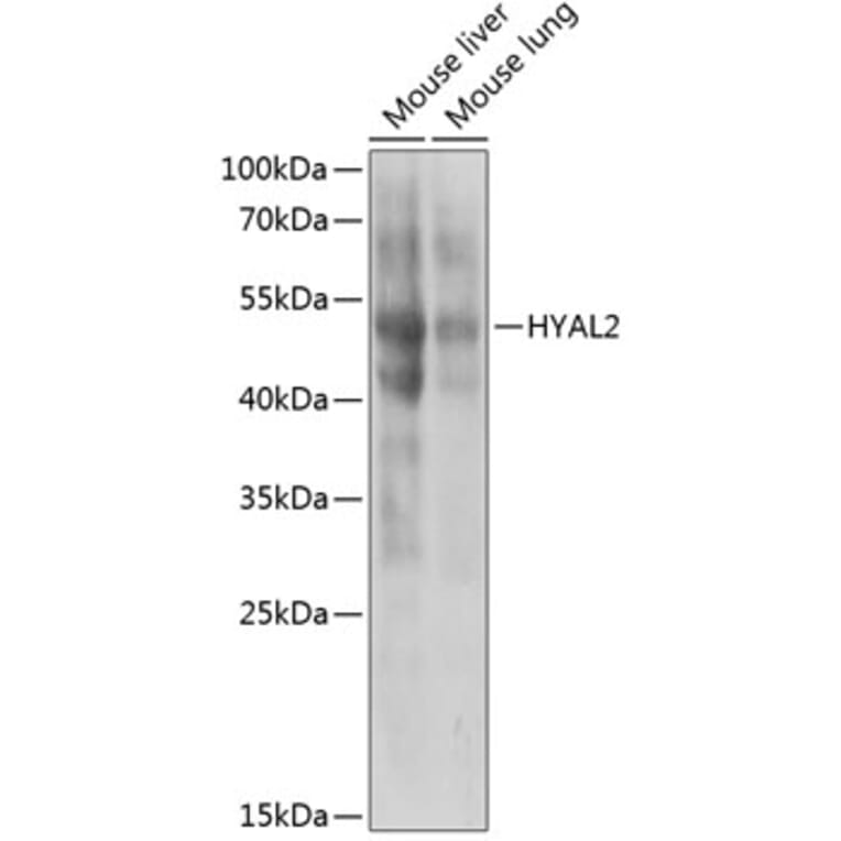 Western Blot - Anti-HYAL2 Antibody (A6624) - Antibodies.com