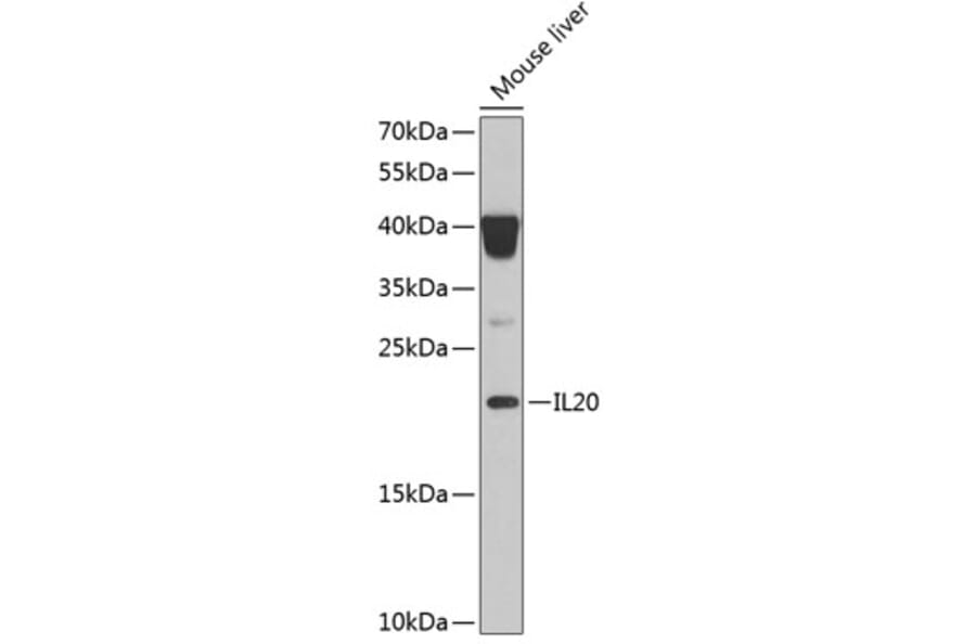 Western Blot - Anti-IL-20 Antibody (A11996) - Antibodies.com