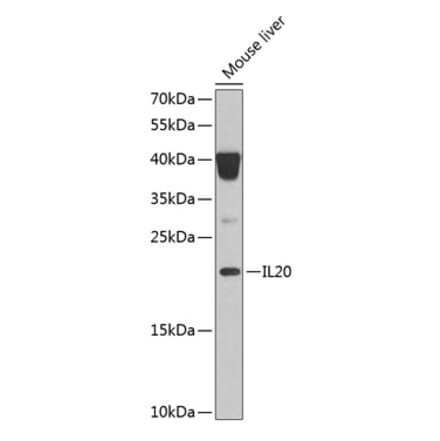 Western Blot - Anti-IL-20 Antibody (A11996) - Antibodies.com