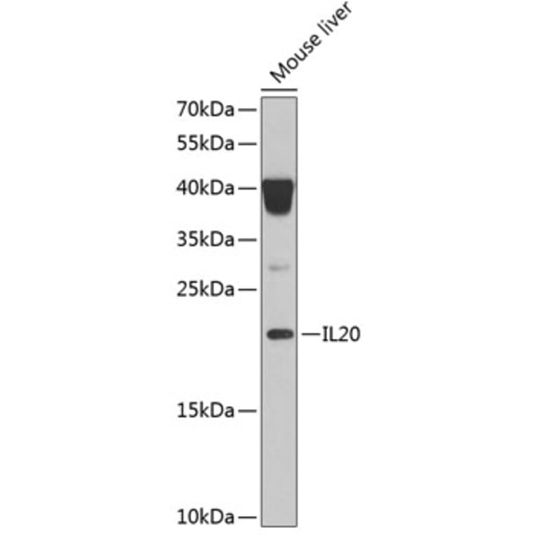 Western Blot - Anti-IL-20 Antibody (A11996) - Antibodies.com