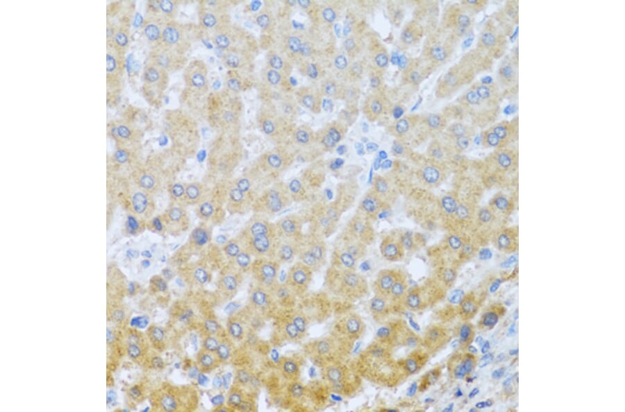 Immunohistochemistry - Anti-IL-20 Antibody (A11996) - Antibodies.com