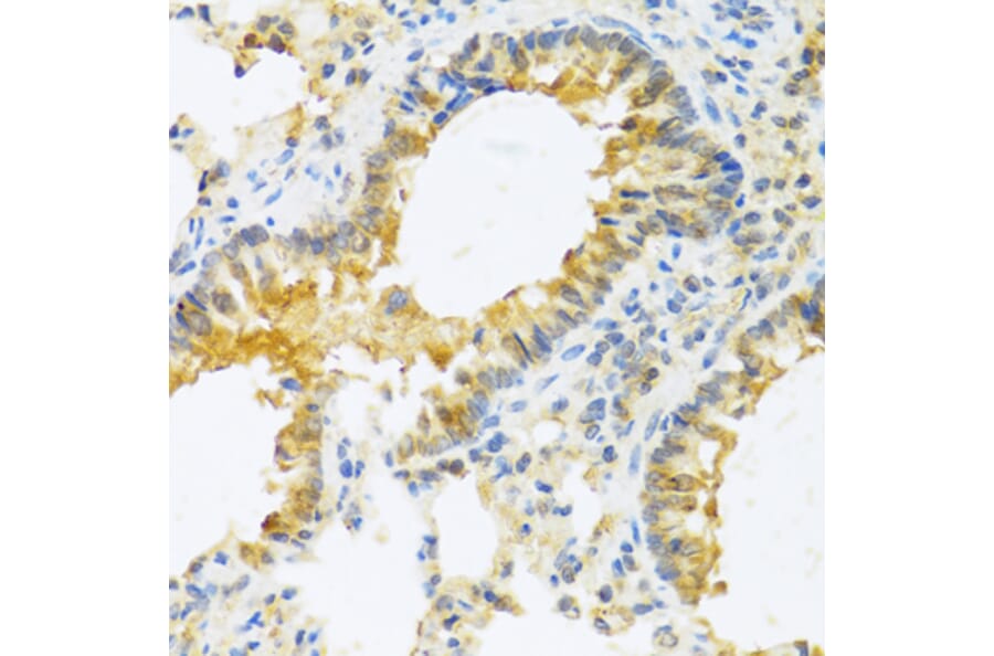 Immunohistochemistry - Anti-IL-20 Antibody (A11996) - Antibodies.com