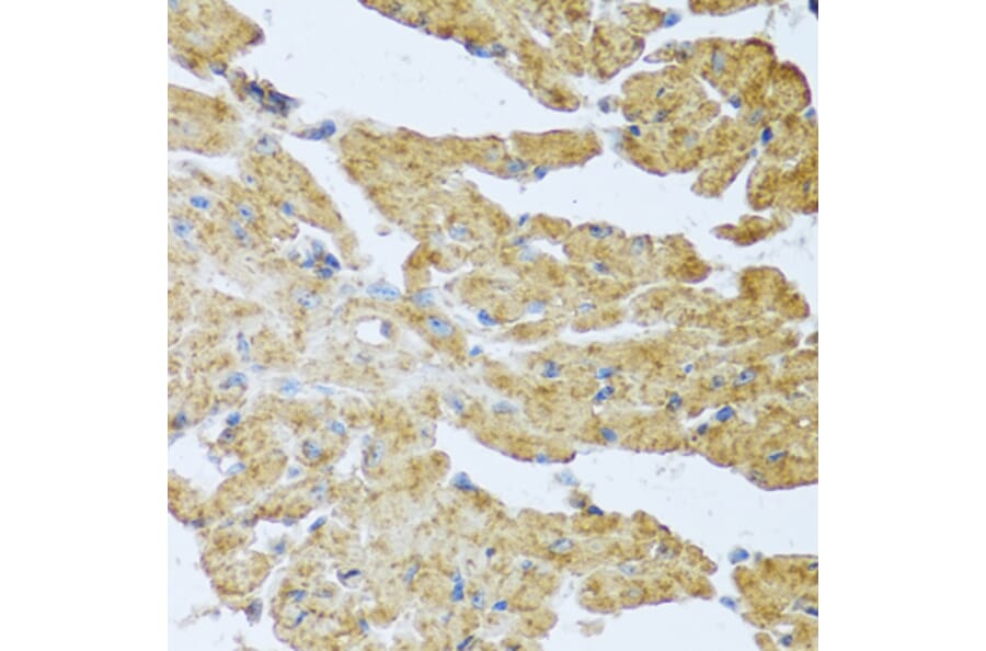Immunohistochemistry - Anti-IL-20 Antibody (A11996) - Antibodies.com