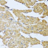 Immunohistochemistry - Anti-IL-20 Antibody (A11996) - Antibodies.com