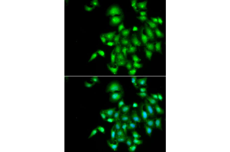 Immunofluorescence - Anti-IL-20 Antibody (A11996) - Antibodies.com