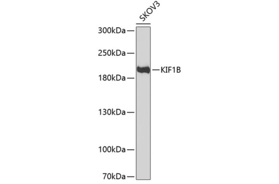 Western Blot - Anti-KIF1B Antibody (A11997) - Antibodies.com