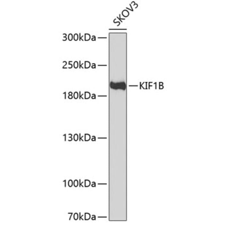 Western Blot - Anti-KIF1B Antibody (A11997) - Antibodies.com