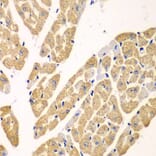 Immunohistochemistry - Anti-L-Kynurenine Hydrolase Antibody (A11998) - Antibodies.com
