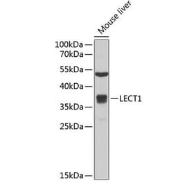 Western Blot - Anti-LECT1 Antibody (A11999) - Antibodies.com
