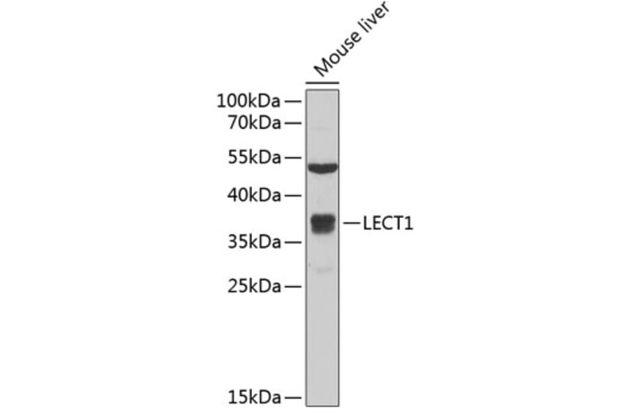 Western Blot - Anti-LECT1 Antibody (A11999) - Antibodies.com