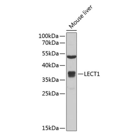 Western Blot - Anti-LECT1 Antibody (A11999) - Antibodies.com