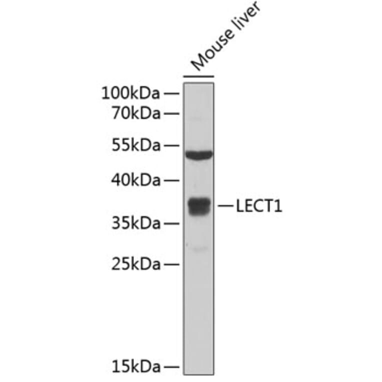 Western Blot - Anti-LECT1 Antibody (A11999) - Antibodies.com