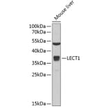 Western Blot - Anti-LECT1 Antibody (A11999) - Antibodies.com