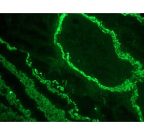 Immunofluorescence - Anti-alpha Smooth Muscle Actin Antibody [1A4] (A115506) - Antibodies.com