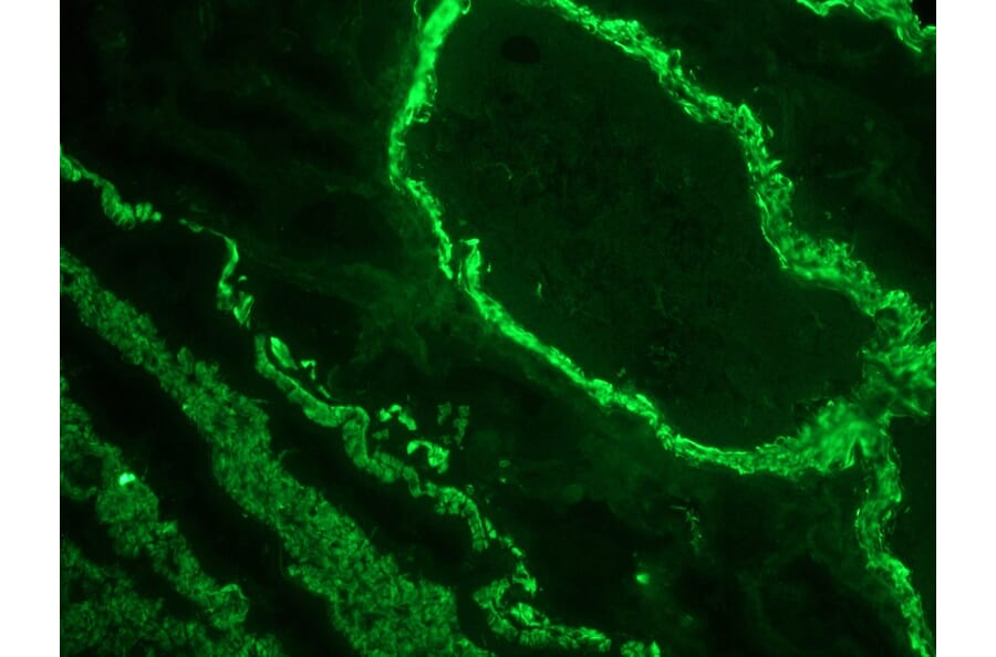 Immunofluorescence - Anti-alpha Smooth Muscle Actin Antibody [1A4] (A115506) - Antibodies.com