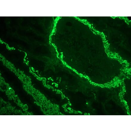 Immunofluorescence - Anti-alpha Smooth Muscle Actin Antibody [1A4] (A115506) - Antibodies.com