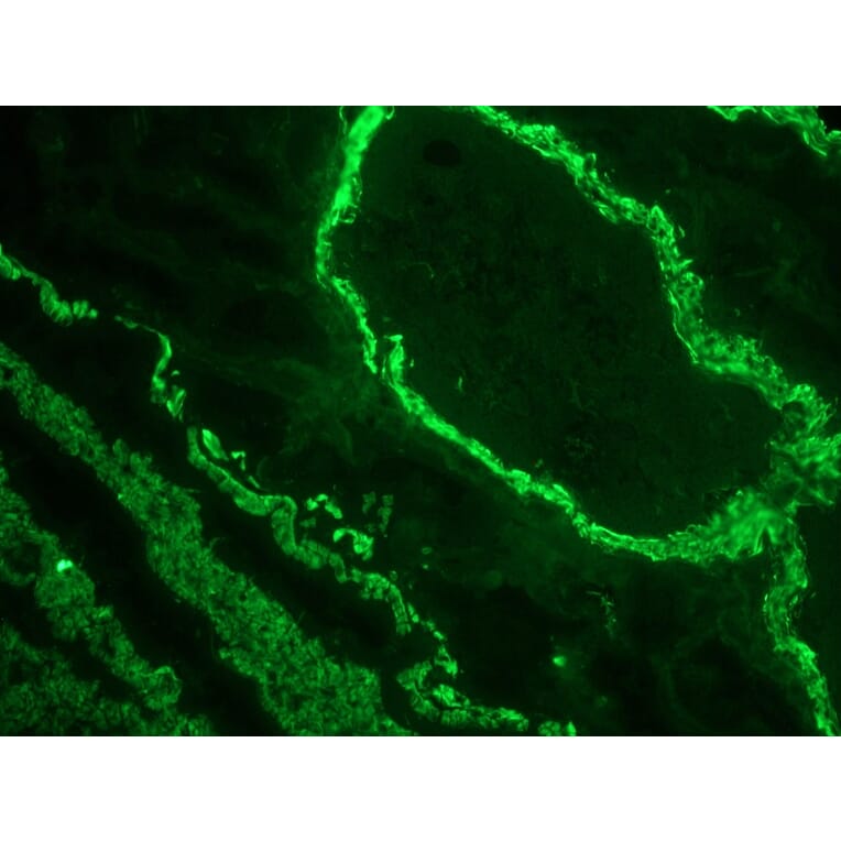 Immunofluorescence - Anti-alpha Smooth Muscle Actin Antibody [1A4] (A115506) - Antibodies.com