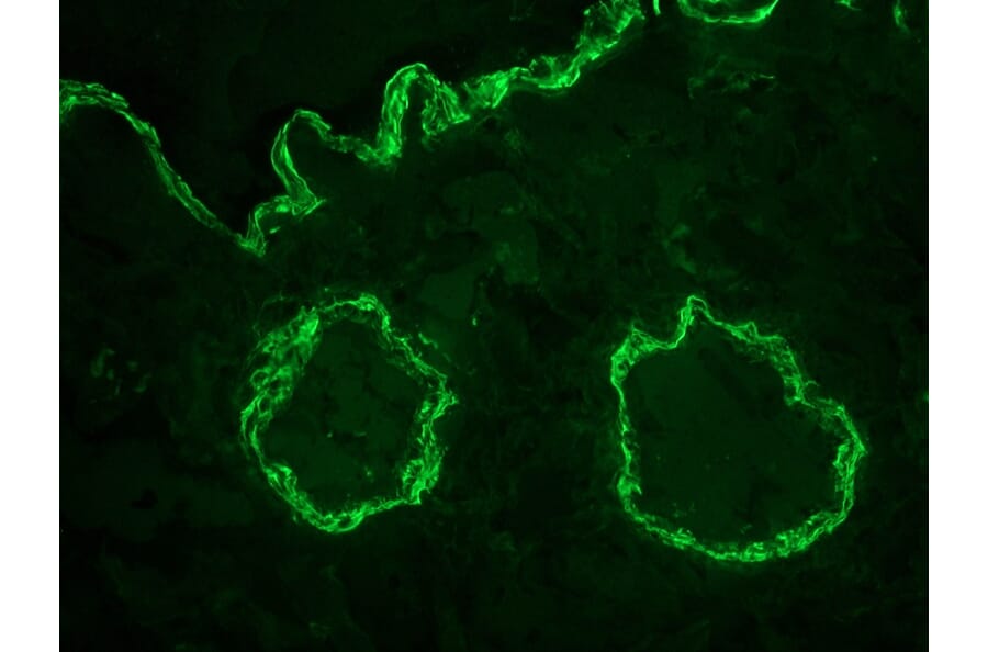 Immunofluorescence - Anti-alpha Smooth Muscle Actin Antibody [1A4] (A115506) - Antibodies.com