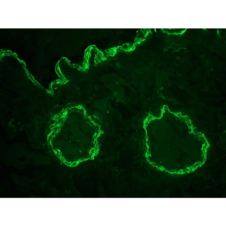 Immunofluorescence - Anti-alpha Smooth Muscle Actin Antibody [1A4] (A115506) - Antibodies.com