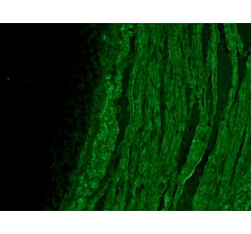 Immunofluorescence - Anti-alpha Smooth Muscle Actin Antibody [HHF35] (A115508) - Antibodies.com