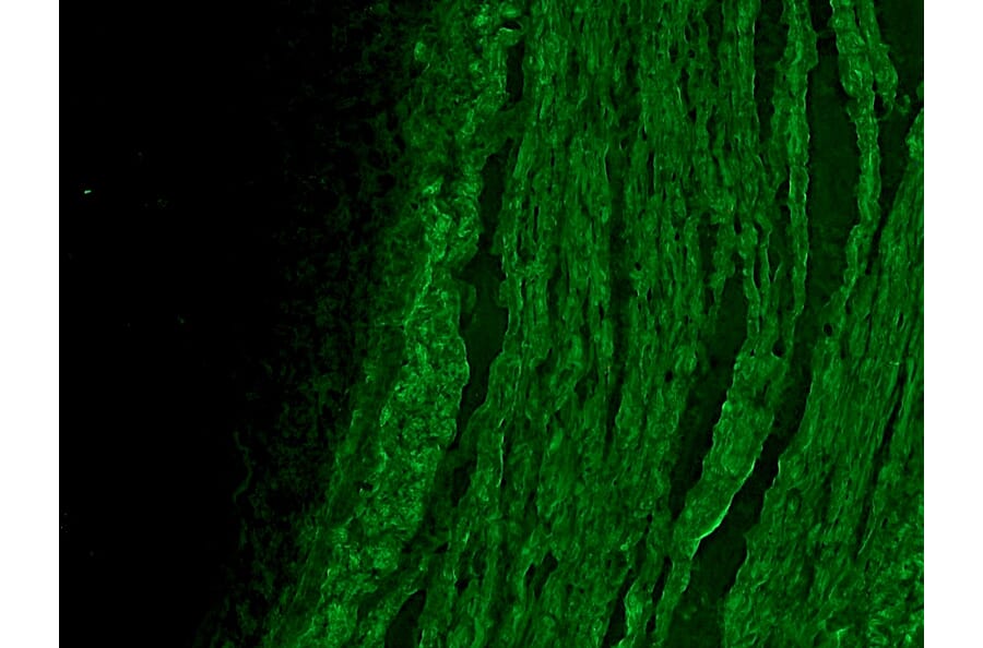 Immunofluorescence - Anti-alpha Smooth Muscle Actin Antibody [HHF35] (A115508) - Antibodies.com