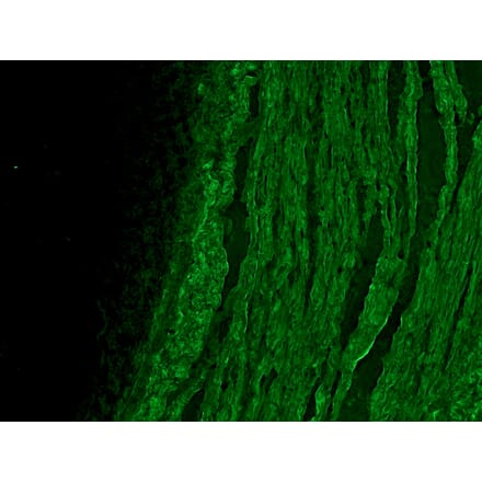 Immunofluorescence - Anti-alpha Smooth Muscle Actin Antibody [HHF35] (A115508) - Antibodies.com