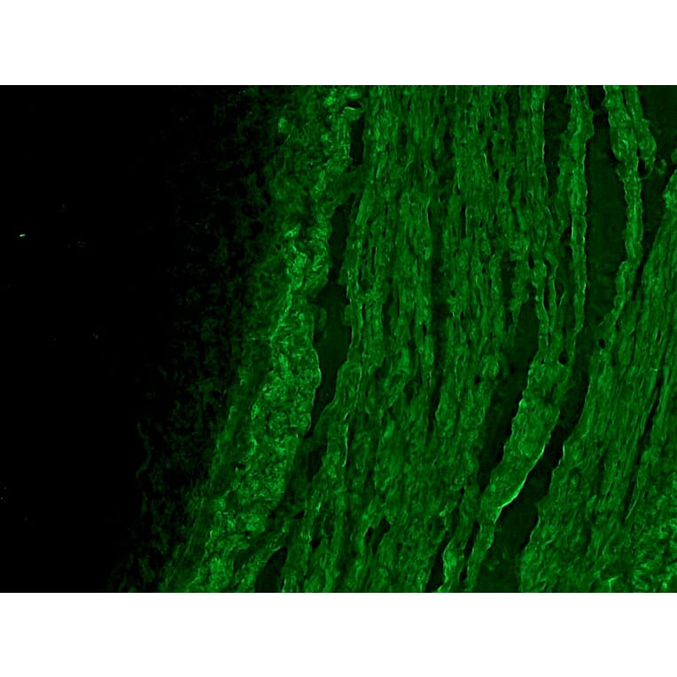 Immunofluorescence - Anti-alpha Smooth Muscle Actin Antibody [HHF35] (A115508) - Antibodies.com