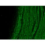 Immunofluorescence - Anti-alpha Smooth Muscle Actin Antibody [HHF35] (A115508) - Antibodies.com