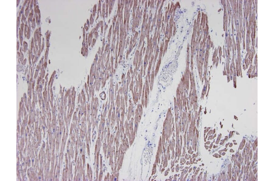Immunohistochemistry - Anti-alpha Smooth Muscle Actin Antibody [HHF35] (A115508) - Antibodies.com