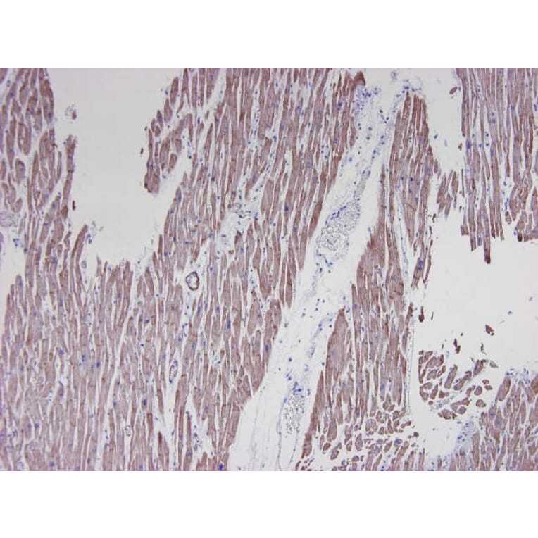 Immunohistochemistry - Anti-alpha Smooth Muscle Actin Antibody [HHF35] (A115508) - Antibodies.com