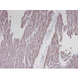 Immunohistochemistry - Anti-alpha Smooth Muscle Actin Antibody [HHF35] (A115508) - Antibodies.com