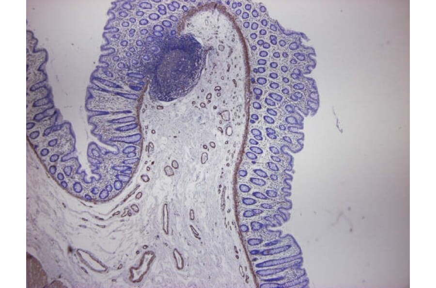 Immunohistochemistry - Anti-alpha Smooth Muscle Actin Antibody [HHF35] (A115508) - Antibodies.com